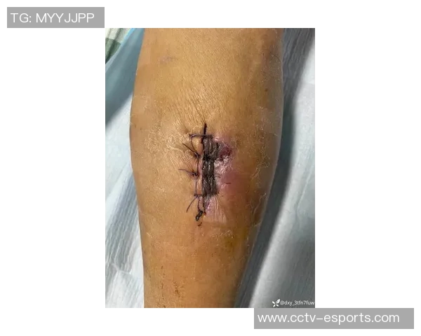 浓眉再遇伤病困扰首节小腿受伤退赛仅得4分4板表现受限